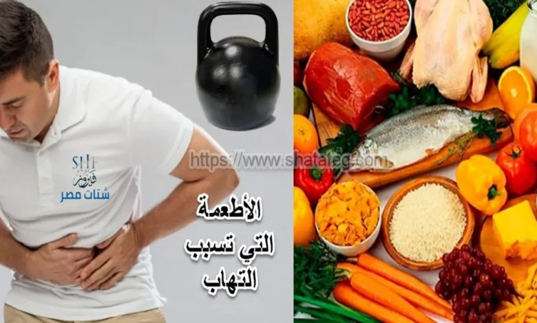 الأطعمة التي تسبب التهاب القولون