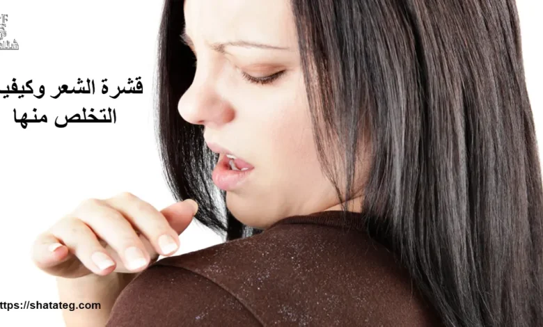 قشرة الشعر
