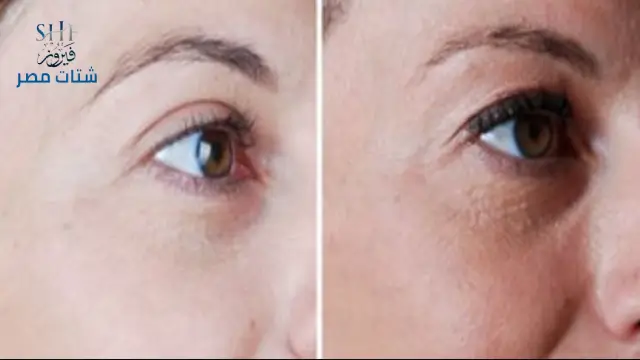 فوائد قشر الرمان