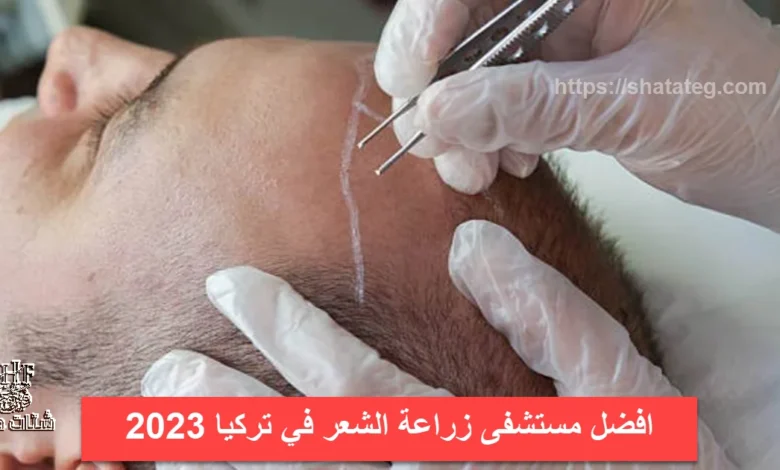 افضل مستشفى زراعة الشعر في تركيا