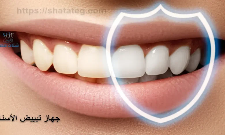 جهاز تبييض الأسنان