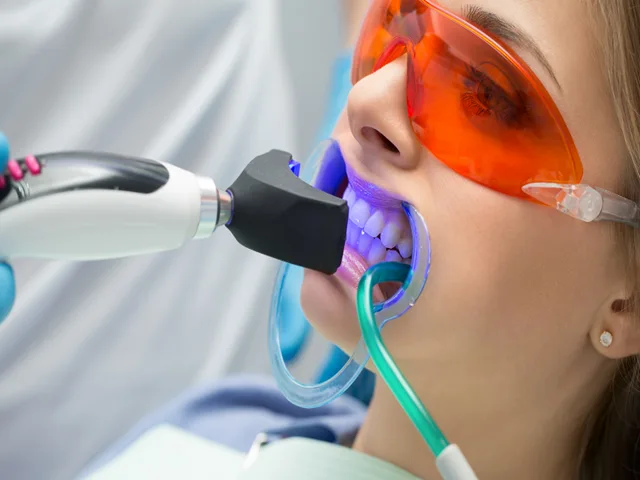 كيف يعمل تبييض الأسنان بتقنية Zoom؟