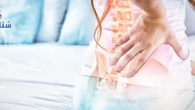 مخاطر عرق النسا