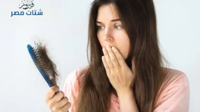 تساقط الشعر بعد الولادة