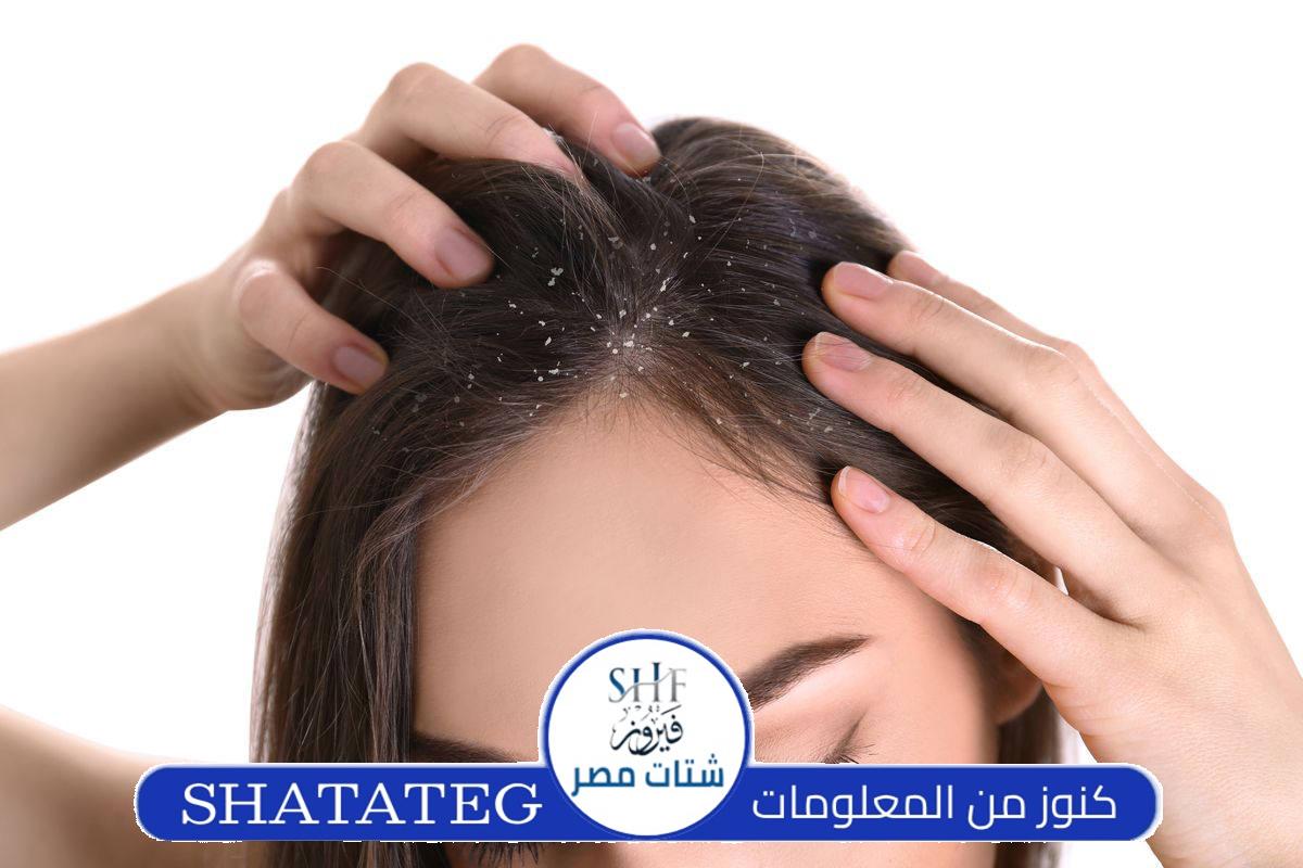 علاج قشرة الشعر