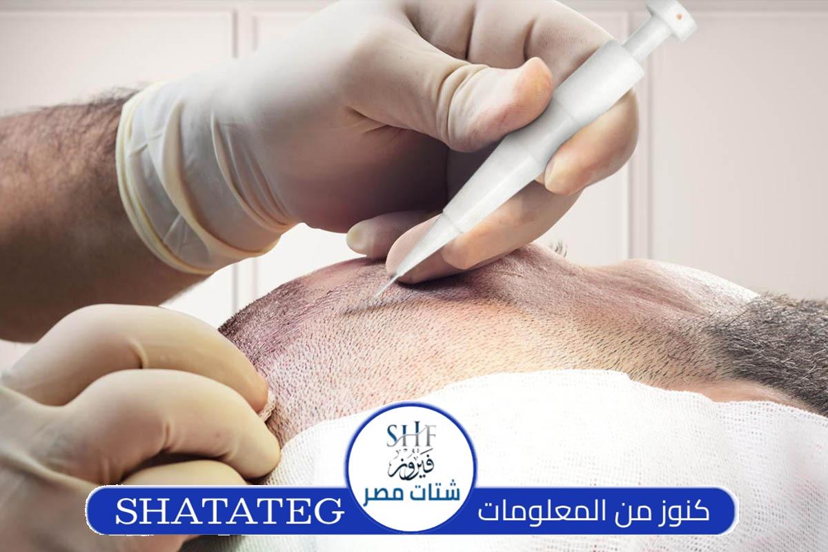 مركز زراعة شعر في تركيا