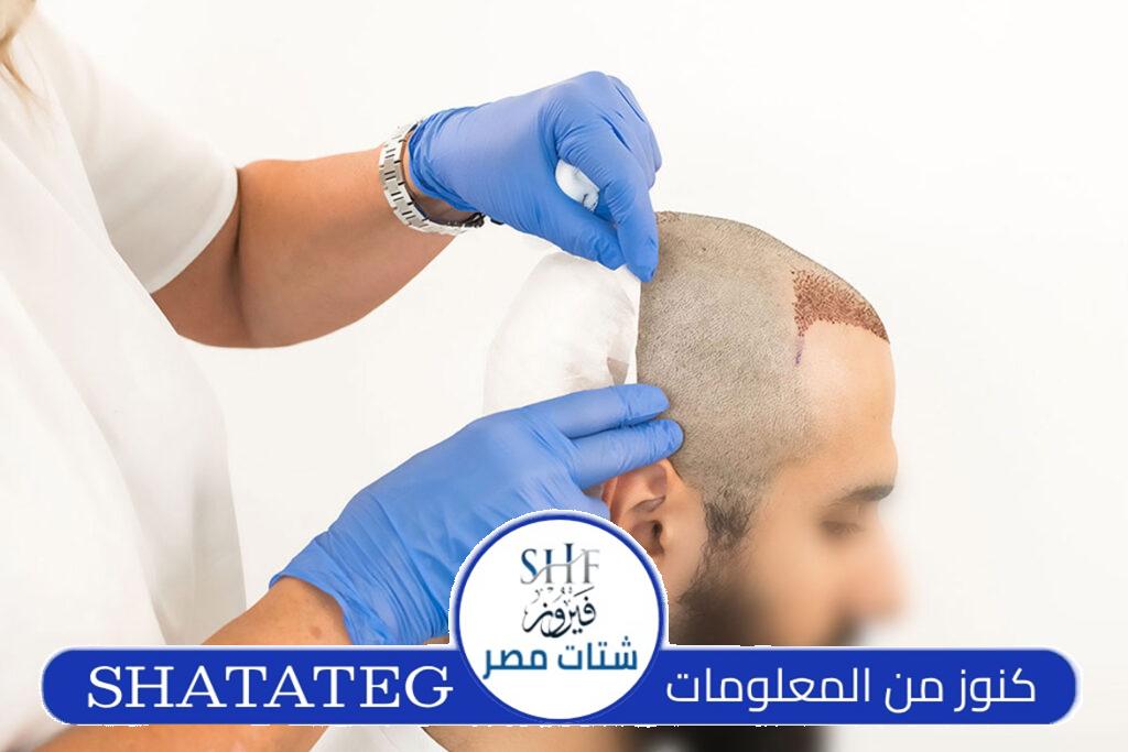 مركز زراعة شعر في تركيا