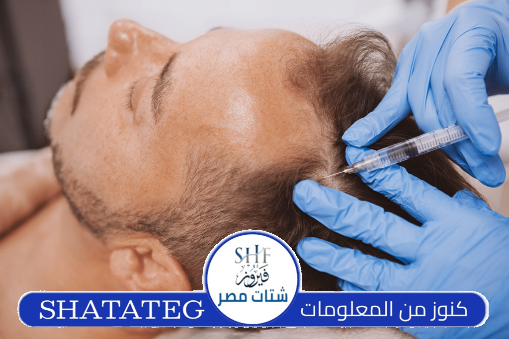 مركز زراعة شعر في تركيا